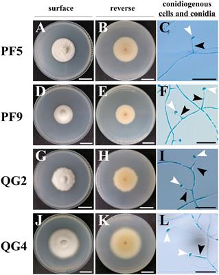 Discovery of Epichloë as novel endophytes of Psathyrostachys lanuginosa in China and their alkaloid profiling